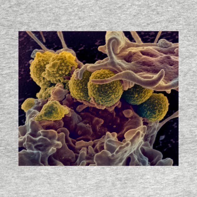 MRSA ingestion by white blood cell, SEM (C021/7464) by SciencePhoto